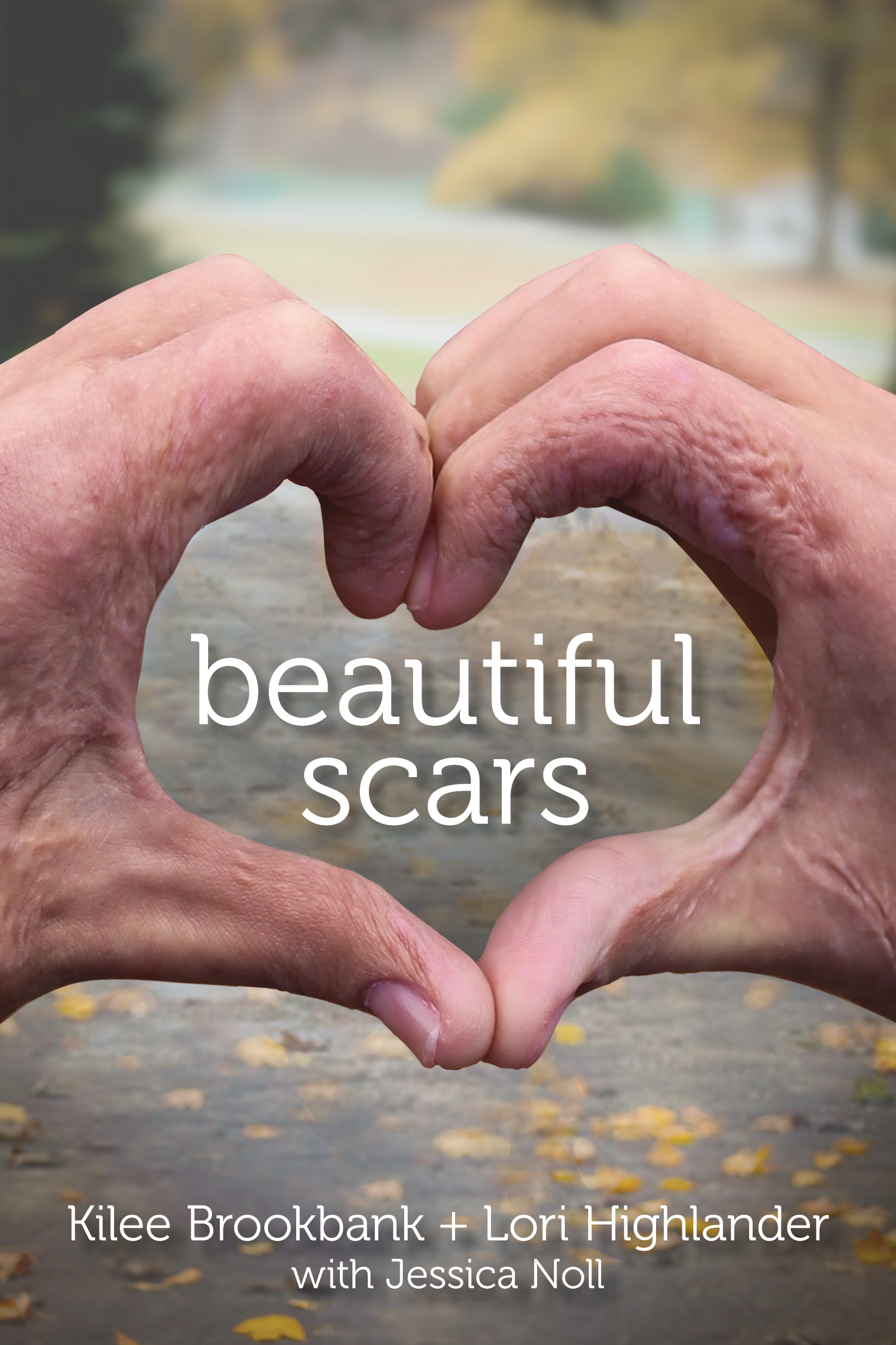 Beautiful-Scars_Cover