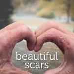 Beautiful Scars